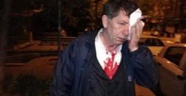 Gazeteci Demirağ'a saldıranları savcılık serbest bıraktı