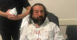 Metin Bozkurt'a saldırı anı kamerada