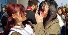 Yüzüne asit atılan Berfin: Kadına şiddet son bulsun