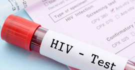 Nijerya'da her gün 47 çocuk ya da genç AIDS'ten ölüyor