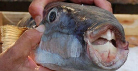 Balık dişleri dolgu ve kaplama olacak