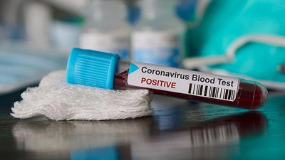 Türkiye'nin coronavirus tablosu: Can kaybı toplamda 4.431