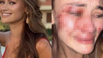 Ukraynalı model Kyryliuk'u darbettiği şüphesiyle gözaltına alınan kişi serbest bırakıldı