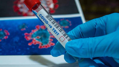 Coronavirus: Vaka sayısı 32 milyonu aştı