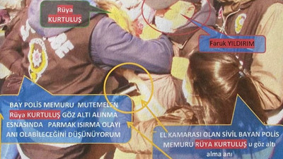 Polis ‘parmağımı ısırdı’ dedi, bilirkişi raporunu başka bir polis verdi, savcı 3 yıl hapis istedi