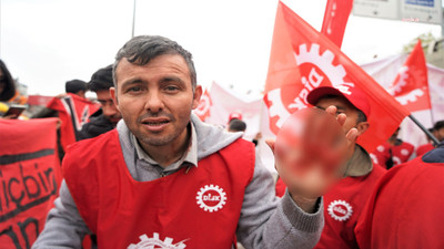 Kafasından darbe alan işçi: Polis telsizle kafamıza vurdu