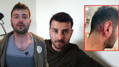 Evden çıkarmak istediği kiracısını hem dövdü hem şikayetçi oldu