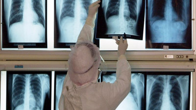 Yapay zeka, X-Ray görüntülerinden insanların ırkını tahmin ediyor; bunun riskleri olabilir