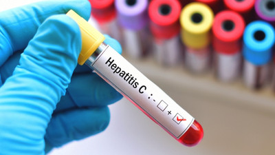 Hepatit: 2 dakikada 1 kişiyi öldürüyor, yüzbinlerce kişi taşıyıcı olduğunu bile bilmiyor