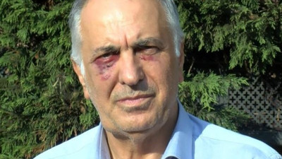 Saldırıya uğrayan Kartal Cemevi Başkanı: Ankara'nın devamı olduğunu düşünüyorum