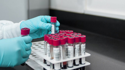 Sahte doktor ve mimardan sonra 'sahte' teşhis: Arkadaşına 2.5 yıl AIDS ilacı içirdi