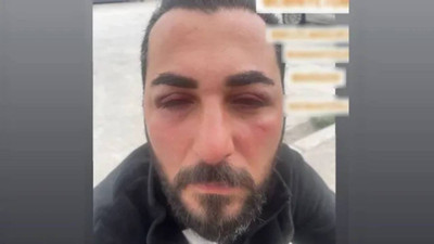 Depremzedelere bekçi şiddeti: 'Burada OHAL var, devlet de yargı da biziz'