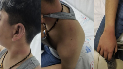 Lice'de 14 yaşındaki çocuğa polis işkencesi Meclis gündeminde