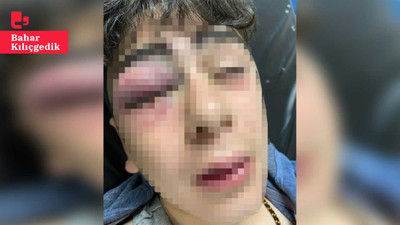Lice'de çocuğa polis işkencesi: 'Silah vardı ama kullanmadık, taş gelmiş olabilir'