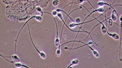 Hollanda yargısından sperm donörüne yasak: 550'den fazla çocuğun babası olmuş