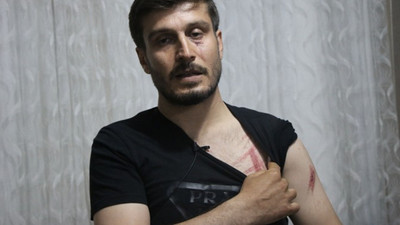 Bismil'de polis şiddetine uğrayan Eşen darp raporu aldı: Yumruk attı, yüzüme ve vücuduma vurdu