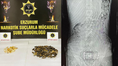 Şüphe üzerine gözaltına alındı: Mide ve bağırsağından toplam 95 kapsül uyuşturucu çıktı