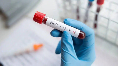 UNAIDS: Dünya genelinde 9,3 milyon kişi HIV tedavisine erişemiyor