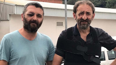 Hopa'da polis şiddeti: Halkevi üyesinin kolunu kırdı