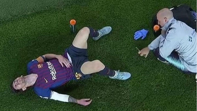 Messi'nin sağ kolu çatladı