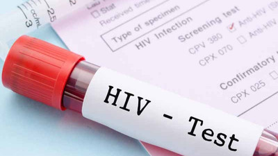 AIDS hastaları için yeni bir umut