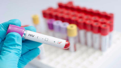 HIV virüsü artık hemen öldüremiyor