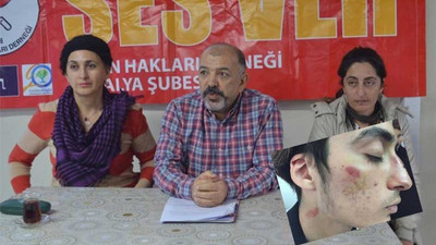 Irkçı saldırı sonrası 'basit yaralama' suçundan soruşturma açıldı