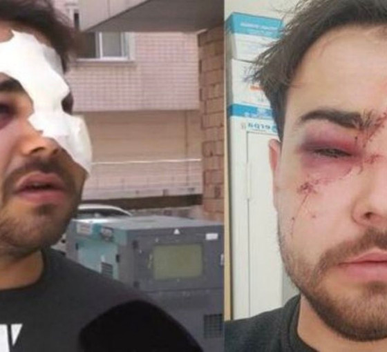 Bir müzisyen daha 'istek parçayı bilmediği için' hedef oldu