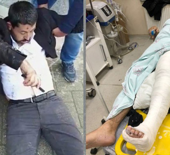 Soylu görüntülere rağmen iddia etti: Habip Eksik’in ayağını HDP’liler kırmış