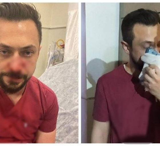 Urfa'da bir doktor, hasta yakının saldırısına uğradı