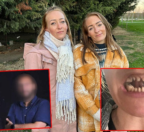 Diş tedavisi için 10 günlüğüne Türkiye'ye gelen Danimarkalı ikizler 2 aydır gidemiyor