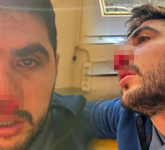 Sağlıkta şiddet durmuyor: İstanbul'da hasta yakını hemşireye yumruklu saldırıda bulundu