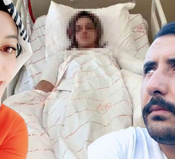 Kadının yüzüne asit atan erkekten 'bildik' savunma: Erkeklik gururuma hakaret ediyordu