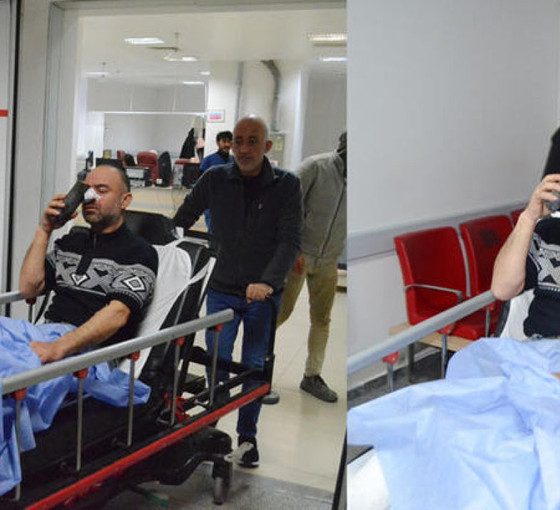 Isınmak için yaktıkları ateşe tiner döken işçi yaralandı