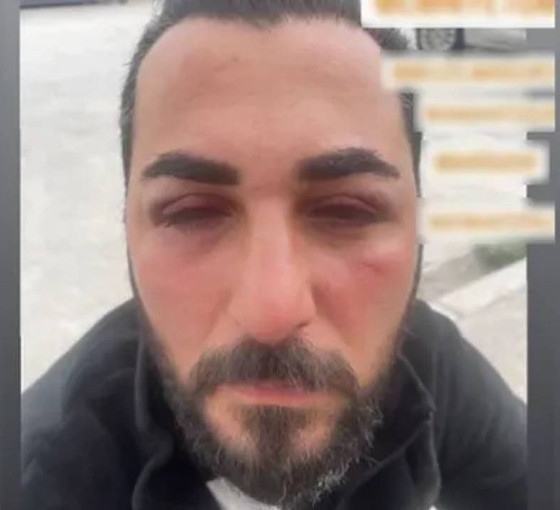 Depremzedelere bekçi şiddeti: 'Burada OHAL var, devlet de yargı da biziz'
