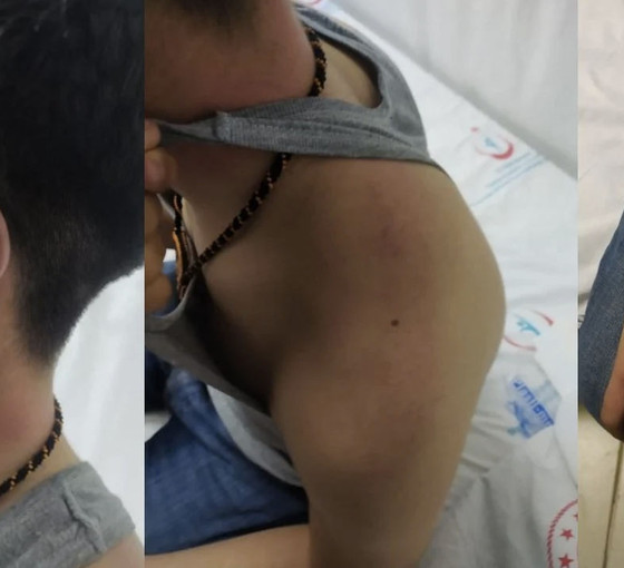 Lice'de 14 yaşındaki çocuğa polis işkencesi Meclis gündeminde