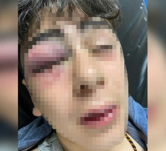 Lice'de çocuğa polis işkencesi: 'Silah vardı ama kullanmadık, taş gelmiş olabilir'