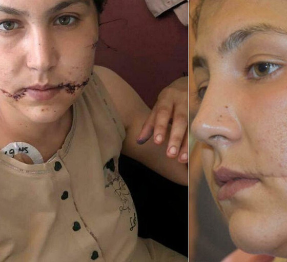Kadına şiddet: Yüzünü doğradı, savcı 'ambulans çağırmış' dedi, tahliye edildi