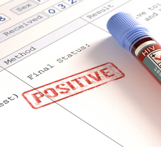 Ameliyat olan hastaya Kızılay’dan verilen kanda HIV tespit edildi