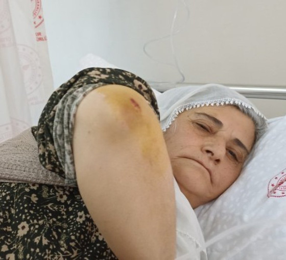 Diyarbakır'da bir kadın, DİSKİ personeli tarafından darp edildi