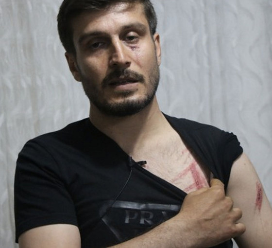 Bismil'de polis şiddetine uğrayan Eşen darp raporu aldı: Yumruk attı, yüzüme ve vücuduma vurdu