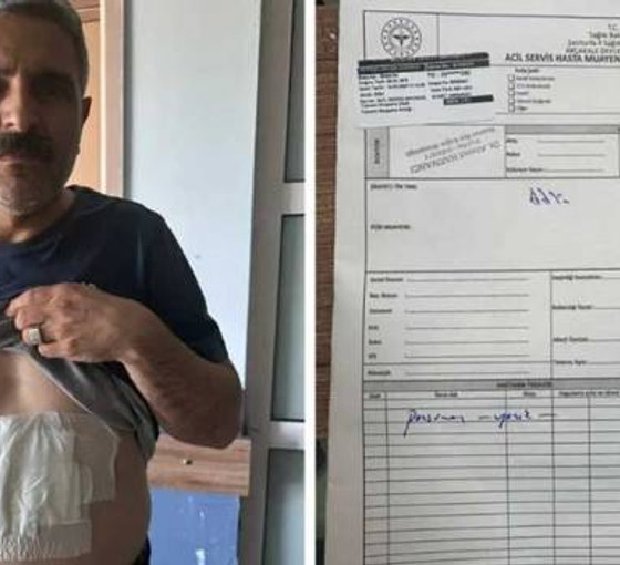 Urfa'da blok oya karşı çıkan sandık görevlisine kaynar su döküldü