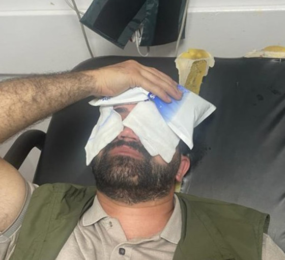 HDP’li Orak’a polis şiddeti: Ameliyatlı gözüne gaz sıkıldı