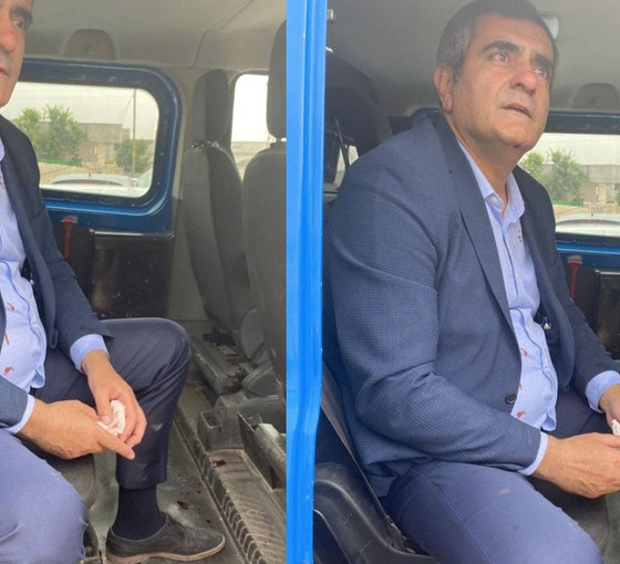 Özgür Özel: Milletvekilimiz Ali Şeker, Şanlıurfa'da darbedildi