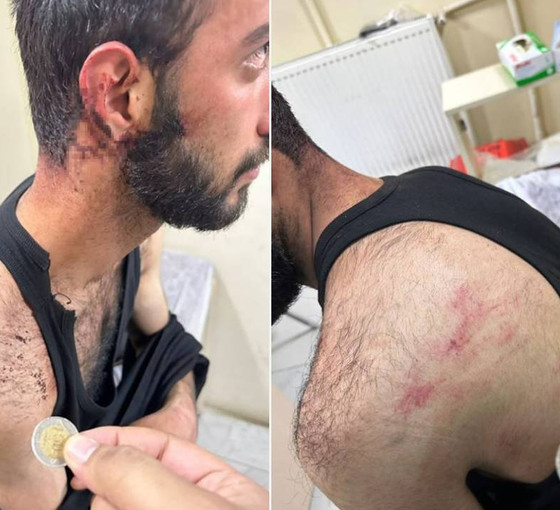 Yüksekova’da polis şiddeti: ‘Eve baskın düzenleyenler Arapça konuşuyordu’