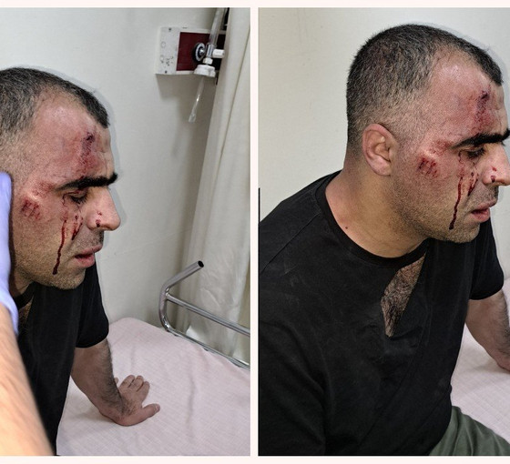 Gazeteci Sinan Aygül Tatvan’da saldırıya uğradı