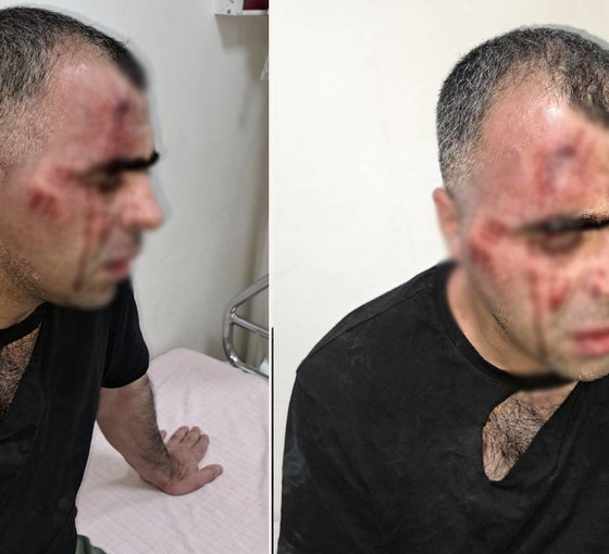 15 bölge barosu gazeteci Sinan Aygül'e saldırıyı kınadı: Halkın haber alma hakkına yapıldı