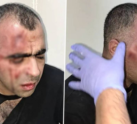 Gazeteci Sinan Aygül'e saldıran korumalar tutuklandı