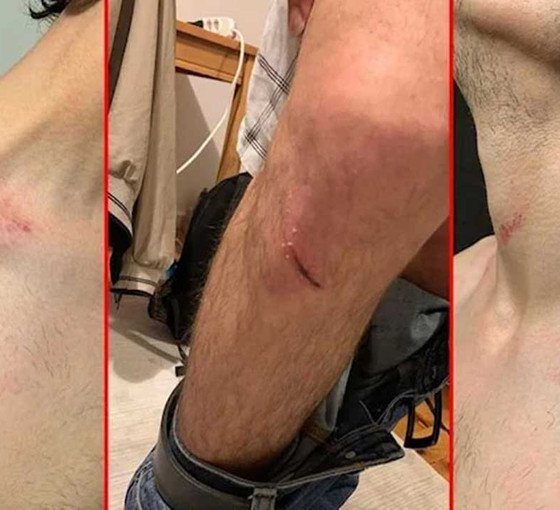 Kalp işareti yaptığı için işkence gören gençten Süleyman Soylu ve korumaları hakkında suç duyurusu