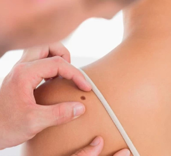 HPV kaynaklı cilt kanseri tedavisinde umut veren aşı